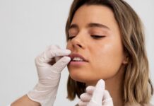 Lip Fillers 101