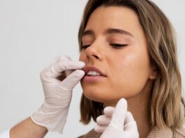 Lip Fillers 101