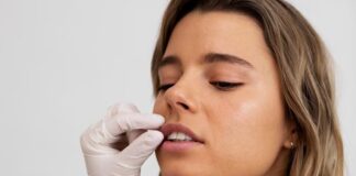 Lip Fillers 101