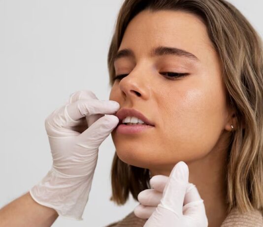 Lip Fillers 101