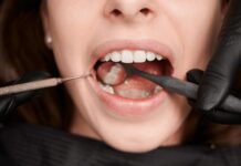 Tips on how Wisdom Teeth Grow in Normally