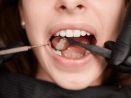 Tips on how Wisdom Teeth Grow in Normally