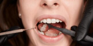 Tips on how Wisdom Teeth Grow in Normally