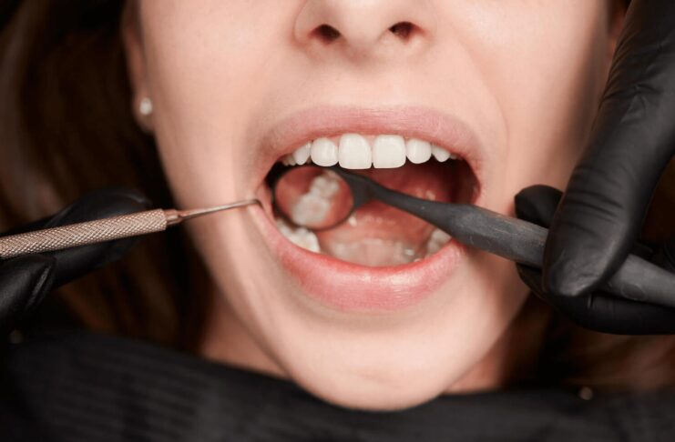 Tips on how Wisdom Teeth Grow in Normally
