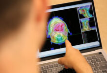 Smarter Treatment Planning