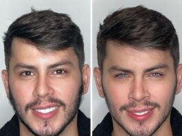 How to Safely Change Your Eye Color Today