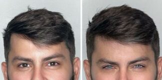 How to Safely Change Your Eye Color Today