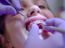 Orthodontic Treatment